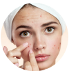 acne-spot-pimple-2